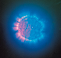 A cancer cell that has been exposed to music